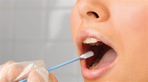 seliwanoff's test|how long is marijuana detectable in saliva.